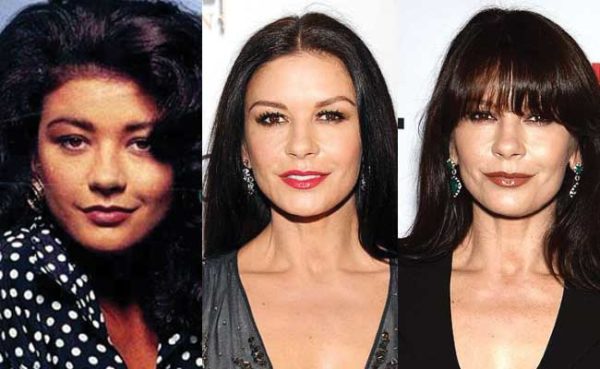 Catherine Zeta Jones Plastic Surgery Before and After Pictures 2024