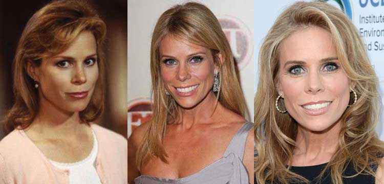 Cheryl Hines Plastic Surgery Before and After Pictures 2022.