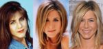 Jennifer Aniston Plastic Surgery Before And After Pictures 2024   Jennifer Aniston Plastic Surgery Before And After Photos 150x71 