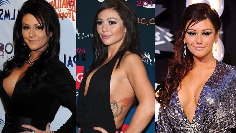 Jwoww Plastic Surgery Before And After Pictures