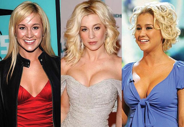 Kellie Pickler Before And After Plastic Surgery 