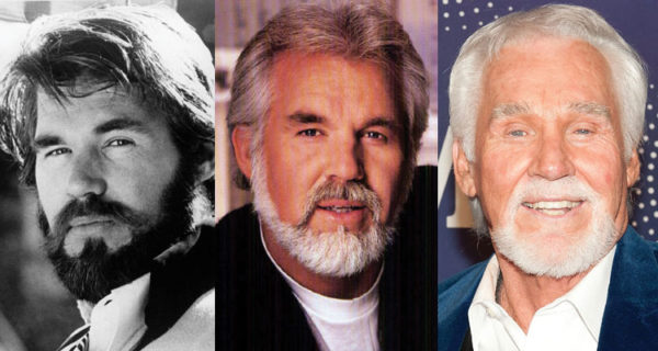 Kenny Rogers Plastic Surgery Before and After Pictures 2024