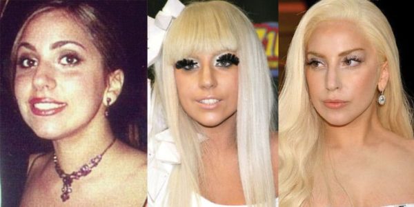 Lady Gaga Plastic Surgery Before and After Pictures 2024