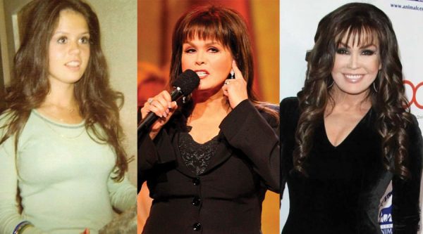 Marie Osmond Plastic Surgery Before and After Pictures 2021