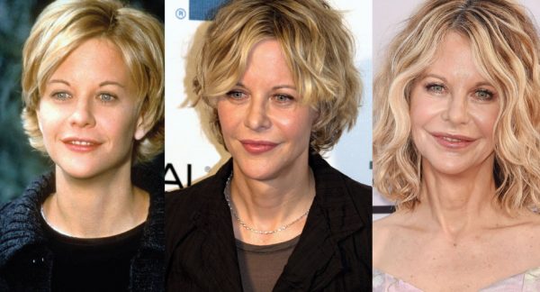 Meg Ryan Plastic Surgery Before and After Pictures 2024