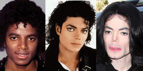 Michael Jackson Plastic Surgery Before and After Pictures 2024