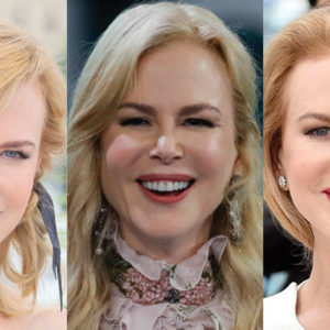 Nicole Kidman Plastic Surgery