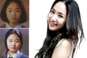 Park Min Young Plastic Surgery Before and After Pictures 2024