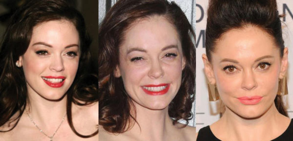 Rose Mcgowan Plastic Surgery Before And After Pictures 2024